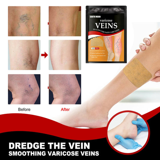 Kenko Spider & Varicose Vein Patches | Natural Herbal