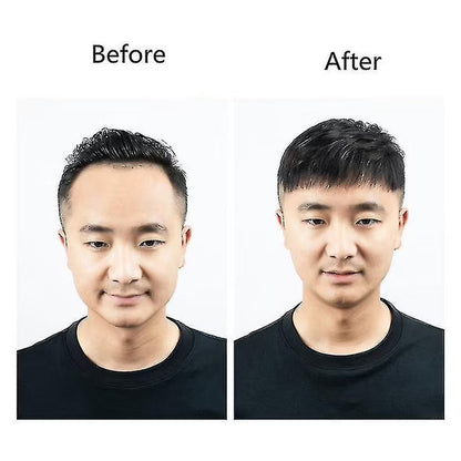Men’s frontal stick-on hairline with natural human hair (Brand – Anemone)