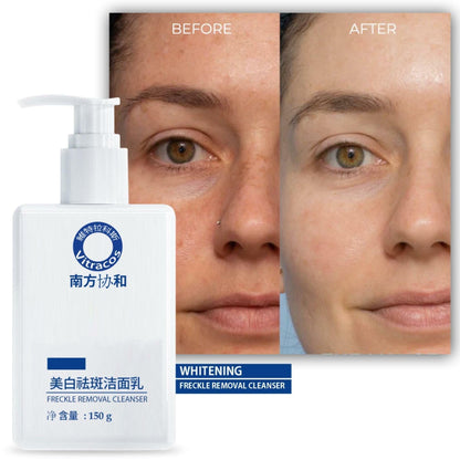 Whitening Facial Cleanser for Freckle Removal & Radiant