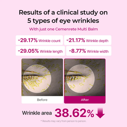 [Dr.Melaxin Official] Cemenrete Calcium Multi Balm